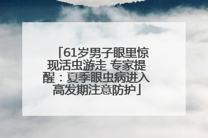 61岁男子眼里惊现活虫游走 专家提醒：夏季眼虫病进入高发期注意防护